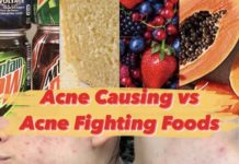 acne fighting foods